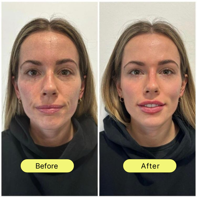 NAD+ Advanced Cellular Renewal