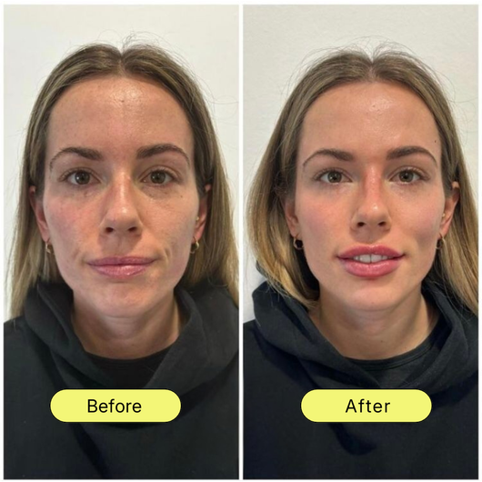 NAD+ Advanced Cellular Renewal