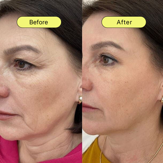 NAD+ Advanced Cellular Renewal