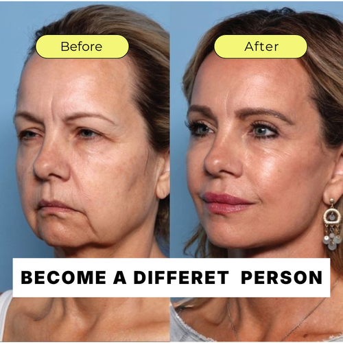 NAD+ Advanced Cellular Renewal